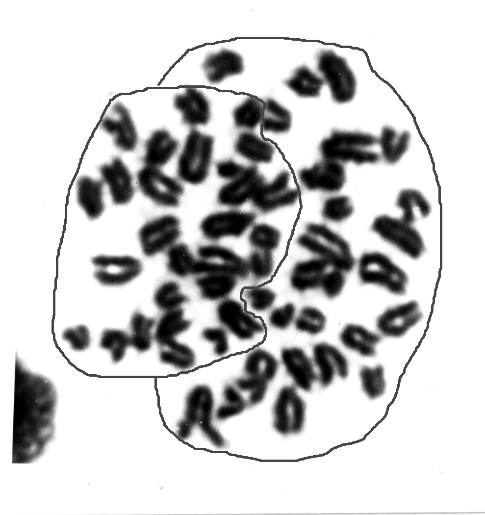 Диплоидные метафазы клеток костного мозга с выделением внутренней подразделенности на гаплоидные субпластинки